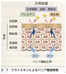 ドライスキンによるバリア機能障害